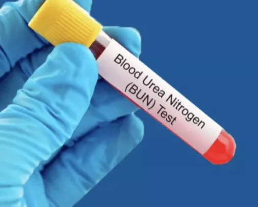 BLOOD UREA SERUM CREATININE TEST