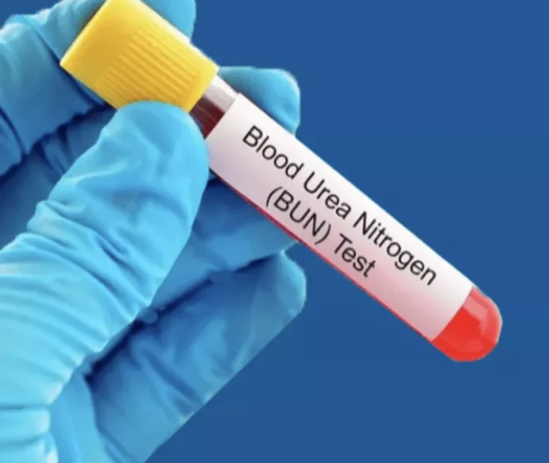 BLOOD UREA SERUM CREATININE TEST