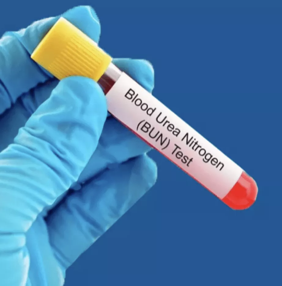BLOOD UREA SERUM CREATININE TEST