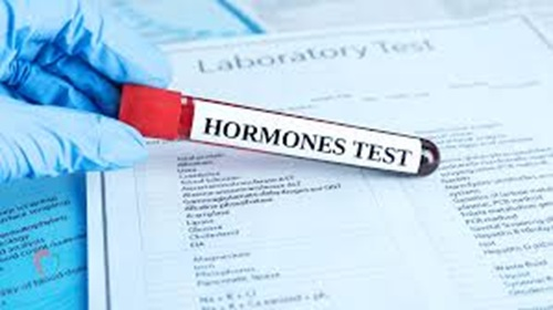 Harmonal Tests at Sri Divya Diagnostics Khammam